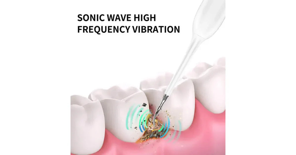 BJLS Electric Ultrasonic Tooth Cleaner | Plaque & Tartar Remover for Teeth at Home - Omnibaya